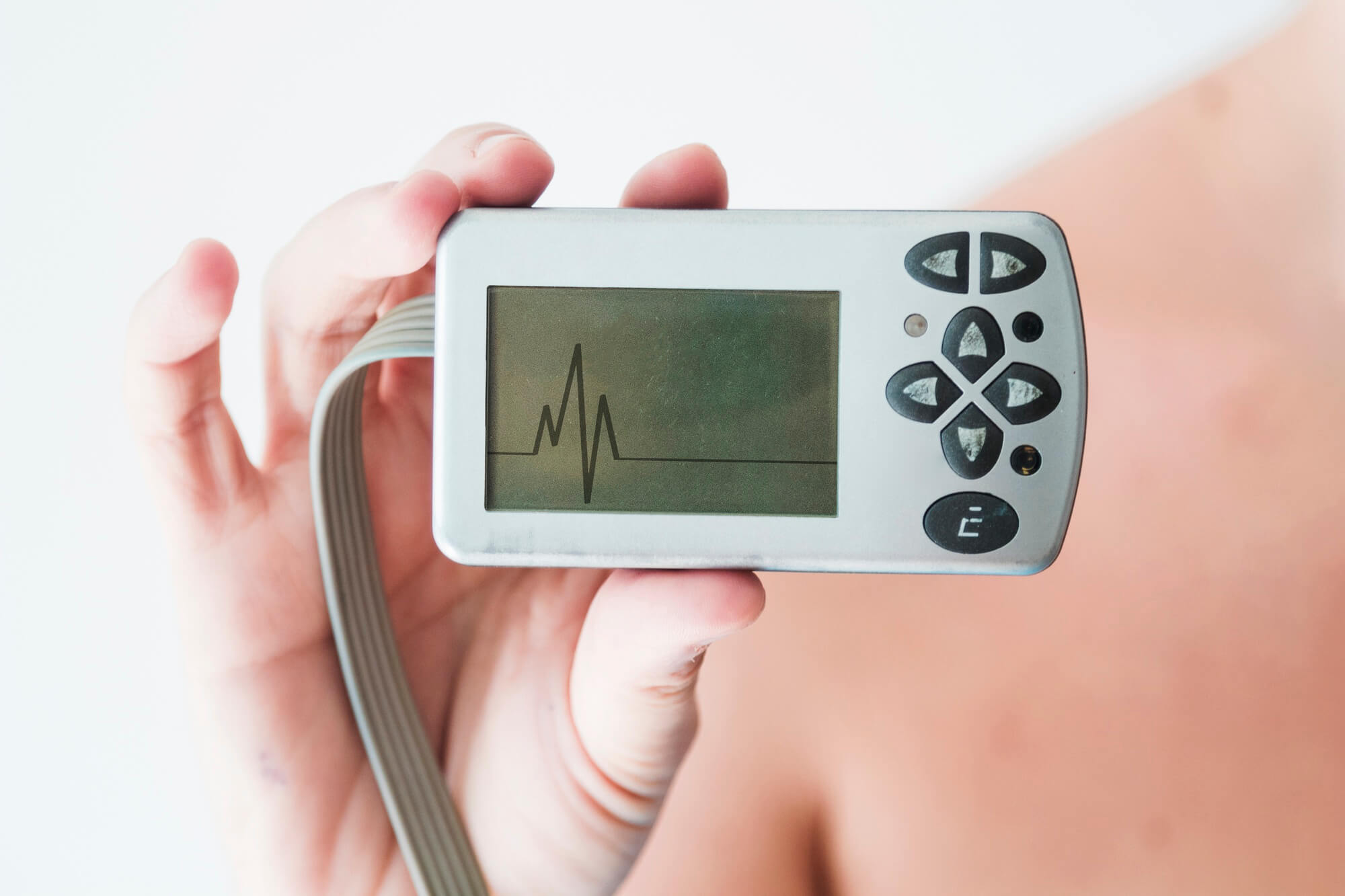 Holter Monitor