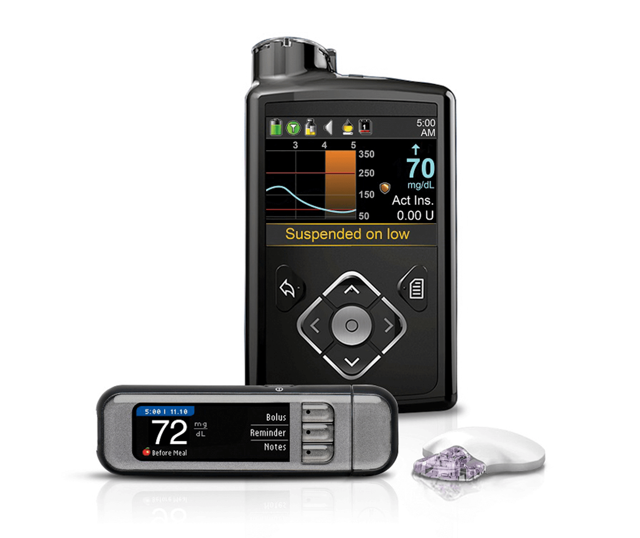 Insulin Pump