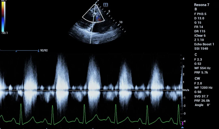 Pencitraan Echocardiography